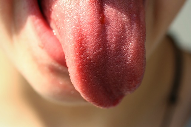 舌苔の除去の方法は 取り過ぎには注意